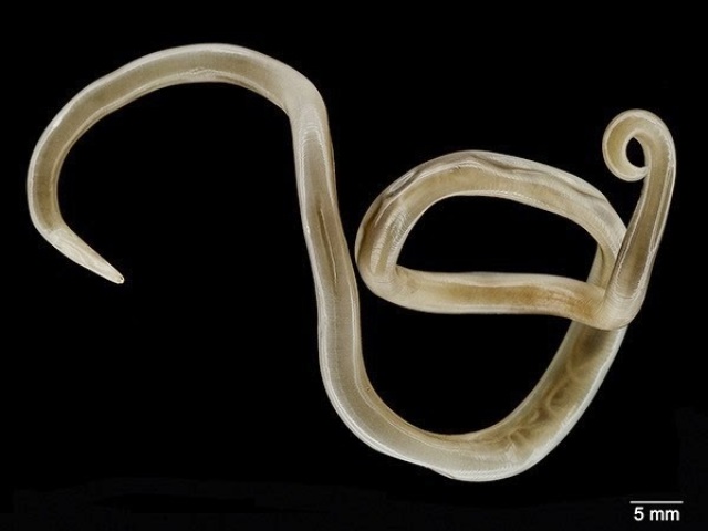 Ascaridíase - Ascaris lumbricoides