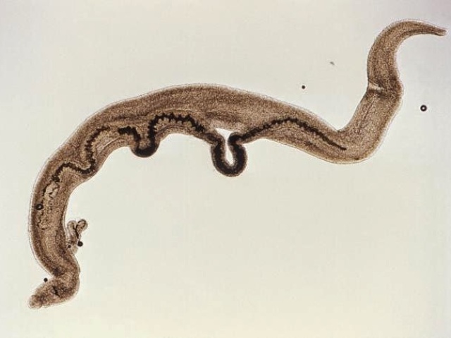 Esquistossomose - Schistosoma mansoni