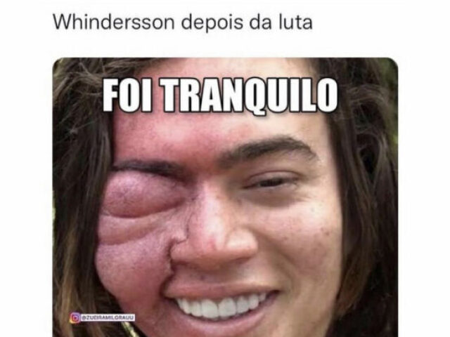 Whindersson depois da luta