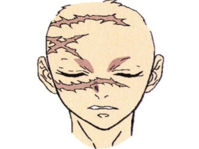 ★ cicatrizes em algum lugar na face ou no corpo.