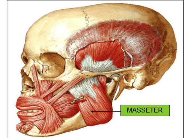 Masseter