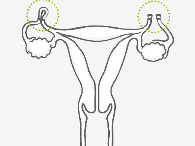 Esterilização