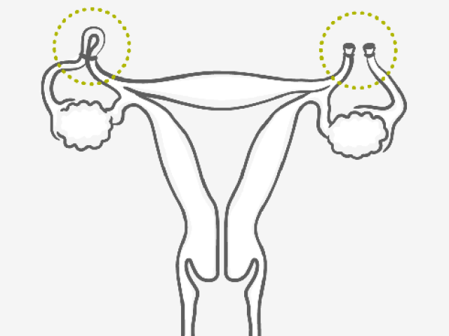 Esterilização