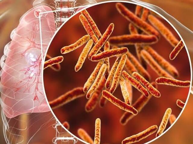 Mycobacterium tuberculosis ou bacilo de Koch.