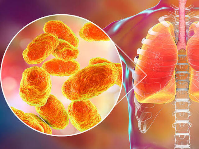 Bordetella Pertussis Tuberculosis.