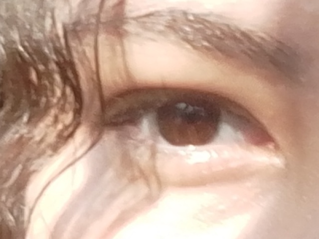 Olhos pequenos