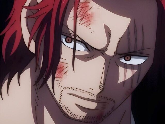 Shanks